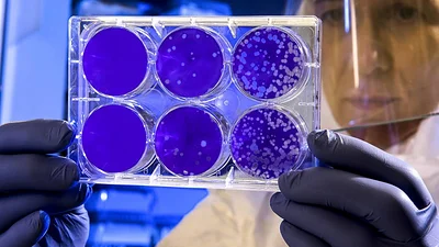nueva cepa del coronavirus en Argentina nueva cepa del coronavirus en Argentina