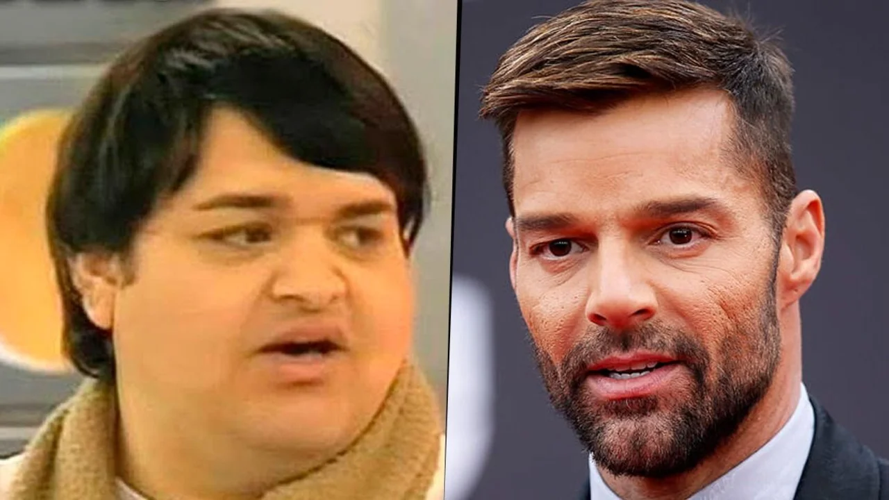 Ex Cuestión de peso se operó 28 veces para parecerse a Ricky Martin
