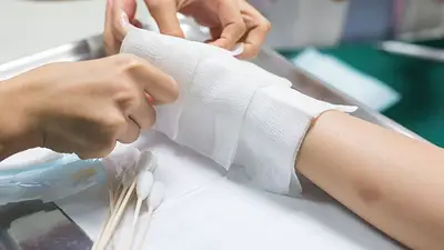 Año nuevo: una beba con el 40% del cuerpo quemado y 35 heridos por pirotecnia y corchos Año nuevo: una beba con el 40% del cuerpo quemado y 35 heridos por pirotecnia y corchos
