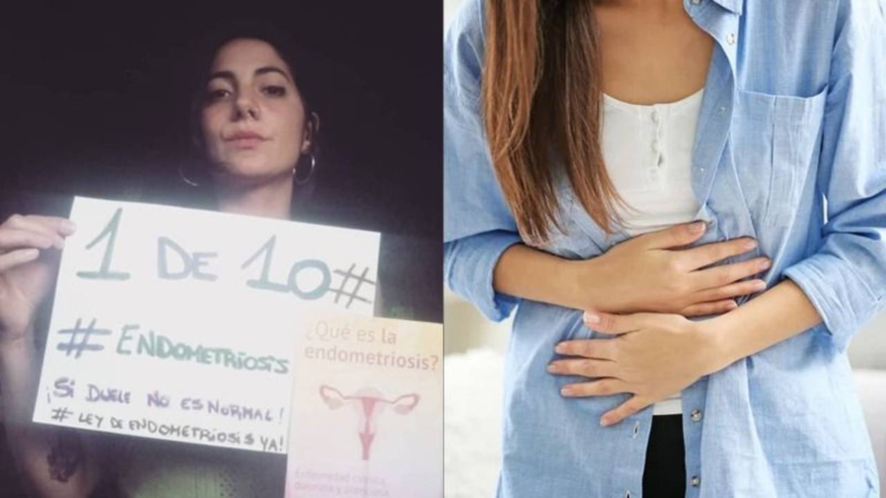 Laura Agazzi, mujer que padece de una endometriosis severa