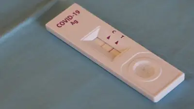 ANMAT autorizó el uso de cuatro "autotest" de coronavirus ANMAT autorizó el uso de cuatro "autotest" de coronavirus