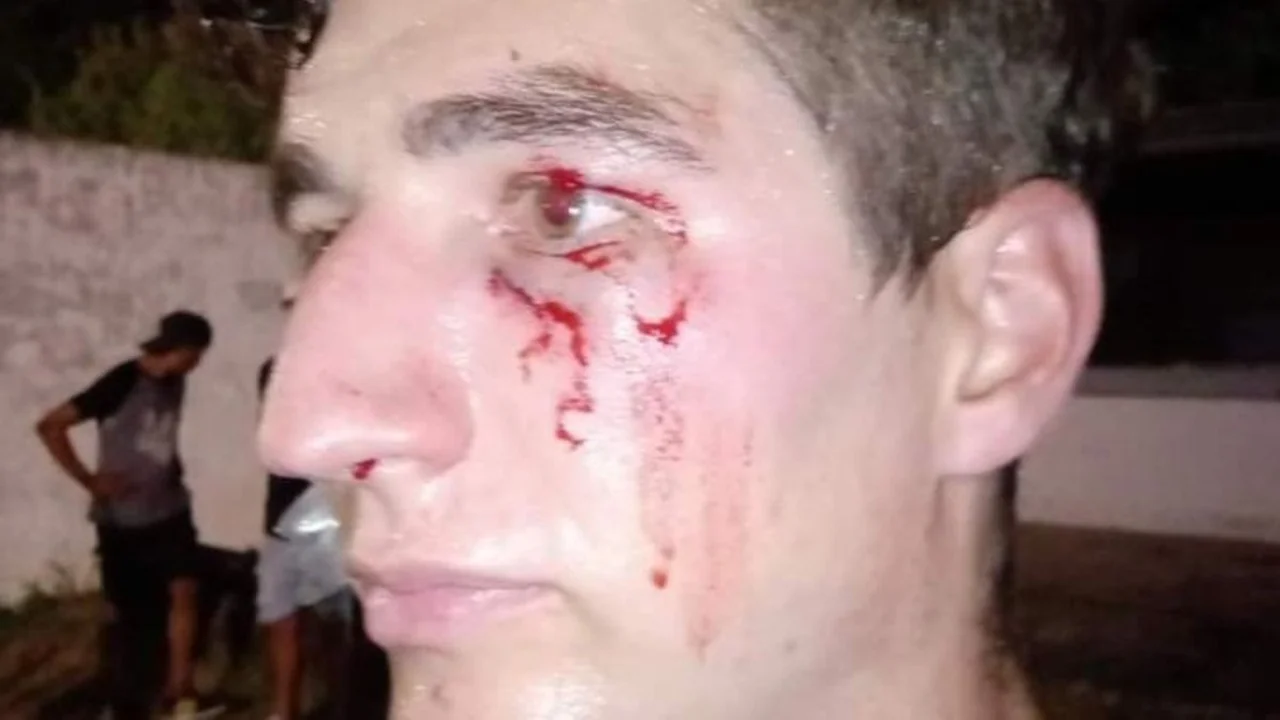 Video de la brutal agresión a un árbitro en pleno campo de juego 