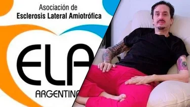Murió Martín Carrizo: qué es la ELA, sus síntomas y causas