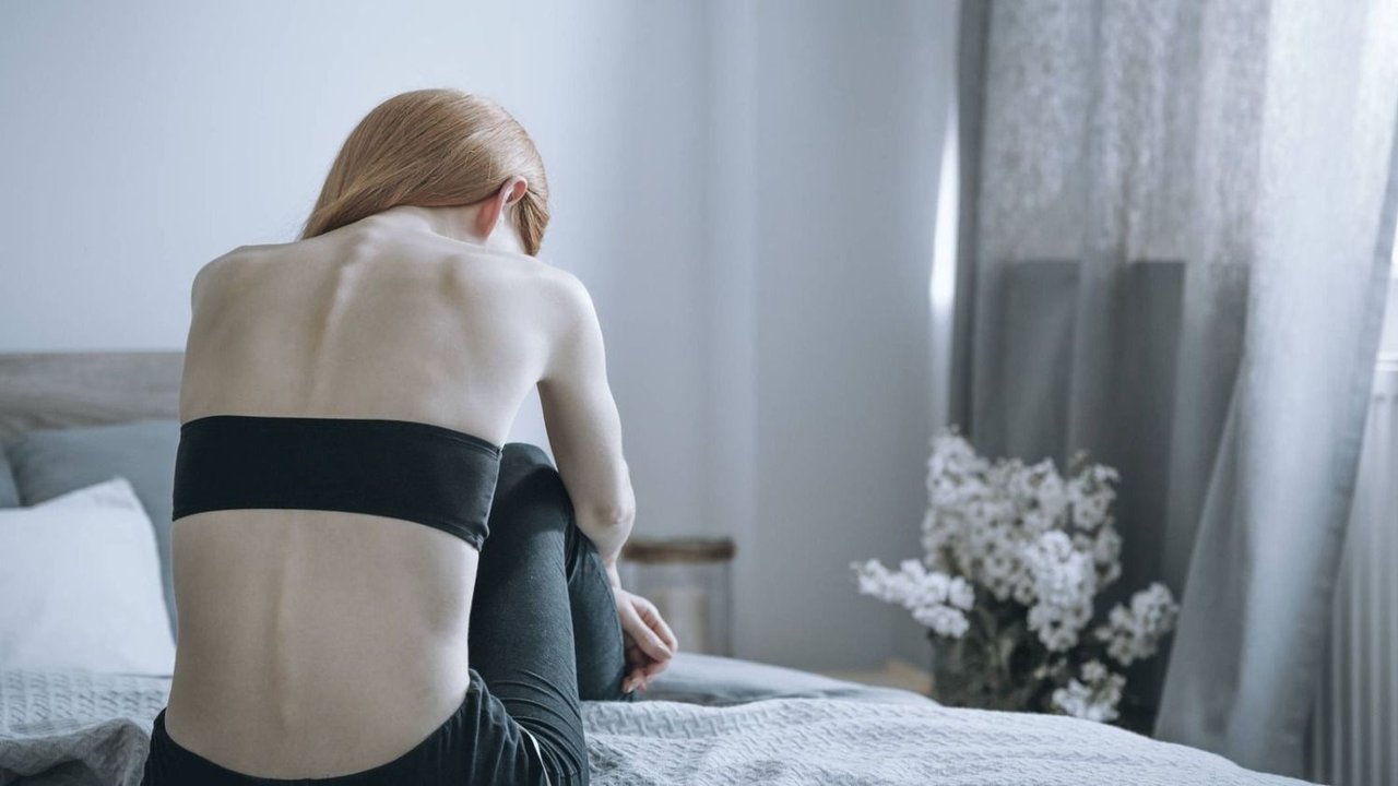 Enfermedades, salud, anorexia nerviosa, sociedad