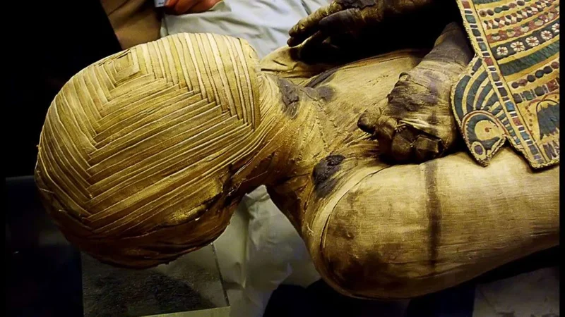 El primer feto en una momia egipcia.