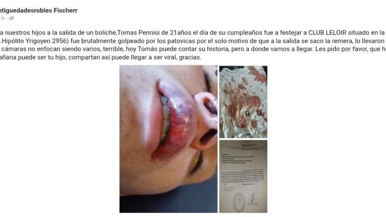 Un joven denunció que fue golpeado por patovicas a la salida de un boliche en Lanús