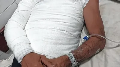 Santa Fe: el hombre quemado por su hermano tras una brutal pelea por una mayonesa aseguró que tuvo "un Dios aparte" Santa Fe: el hombre quemado por su hermano tras una brutal pelea por una mayonesa aseguró que tuvo "un Dios aparte"