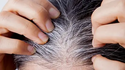 Por qué me salen canas. Por qué me salen canas.