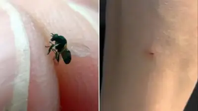 Alerta por nuevo insecto que invade y pica en Buenos Aires: cómo no confundirlo con una mosca Alerta por nuevo insecto que invade y pica en Buenos Aires: cómo no confundirlo con una mosca