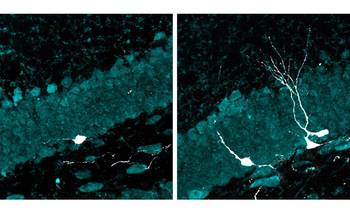 Investigadores del CONICET prueban un nuevo tratamiento para el Alzheimer | Conicet