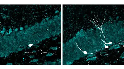 Izq: en blanco, se ve una neurona con dendritas muy incipientes en un cerebro envejecido. Der: tras la estimulación multisensorial, se observa el aumento en la cantidad de neuronas y una mayor complejidad dendrítica. Izq: en blanco, se ve una neurona con dendritas muy incipientes en un cerebro envejecido. Der: tras la estimulación multisensorial, se observa el aumento en la cantidad de neuronas y una mayor complejidad dendrítica.