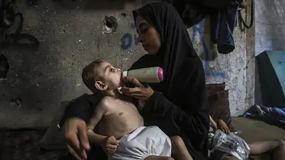 La ONU alertó que hubo 95.000 casos de niños desnutridos en Gaza en 2025 La ONU alertó que hubo 95.000 casos de niños desnutridos en Gaza en 2025