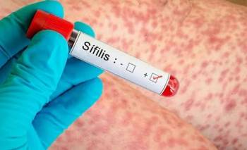 Sífilis: el alarmante informe sobre el récord de casos y los adolescentes en peligro | Salud