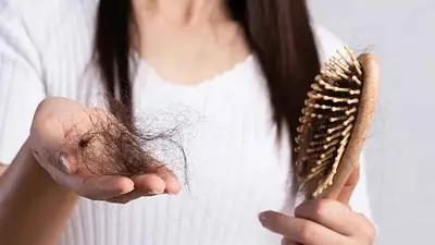 Caída del pelo Caída del pelo