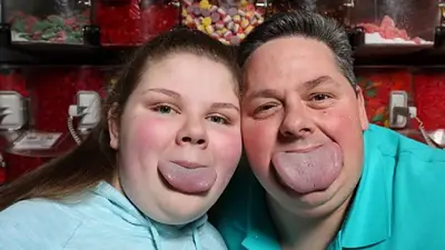 Padre e hija ganaron el record Guinnes por la lengua más ancha del mundo Padre e hija ganaron el record Guinnes por la lengua más ancha del mundo