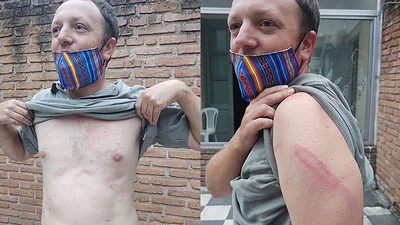 Escándalo: la policía de Morales en Jujuy le pegó a un legislador Escándalo: la policía de Morales en Jujuy le pegó a un legislador