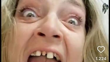 Tamara Paganini explicó por qué se quedó sin dientes