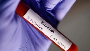 Coronavirus: Once genes explican por qué algunas personas se enferman más que otras