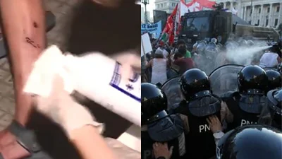 Balazos en el Congreso: varios periodistas resultaron heridos por la policía. Balazos en el Congreso: varios periodistas resultaron heridos por la policía.
