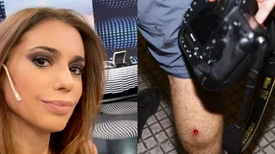 Guadalupe Vázquez y uno de los periodistas heridos con un bala de goma Guadalupe Vázquez y uno de los periodistas heridos con un bala de goma