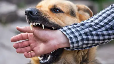 Mordedura de perro. Mordedura de perro.