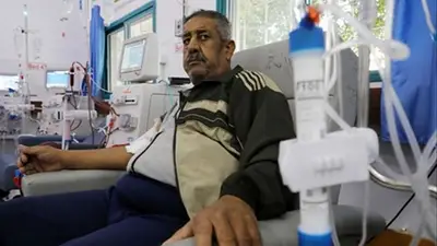 Una persona haciéndose diálisis. Una persona haciéndose diálisis.