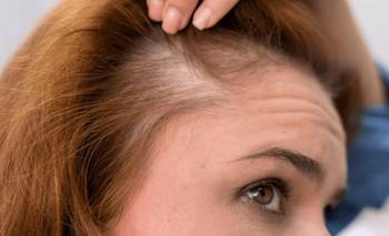 Chau caída del pelo: cómo hacer un shampoo casero de café  | Salud