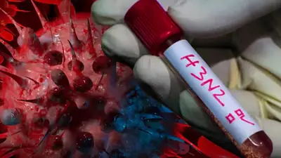 Avanza la gripe H3N2 en Argentina: qué hacer para prevenirla, según los médicos Avanza la gripe H3N2 en Argentina: qué hacer para prevenirla, según los médicos