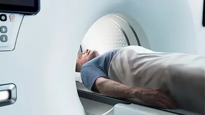 Cáncer en Argentina: 40% de los casos podrían prevenirse evitando factores de riesgo claves Cáncer en Argentina: 40% de los casos podrían prevenirse evitando factores de riesgo claves