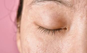 Esto es lo que le pasa a tu piel cuando no dormís lo suficiente | Salud