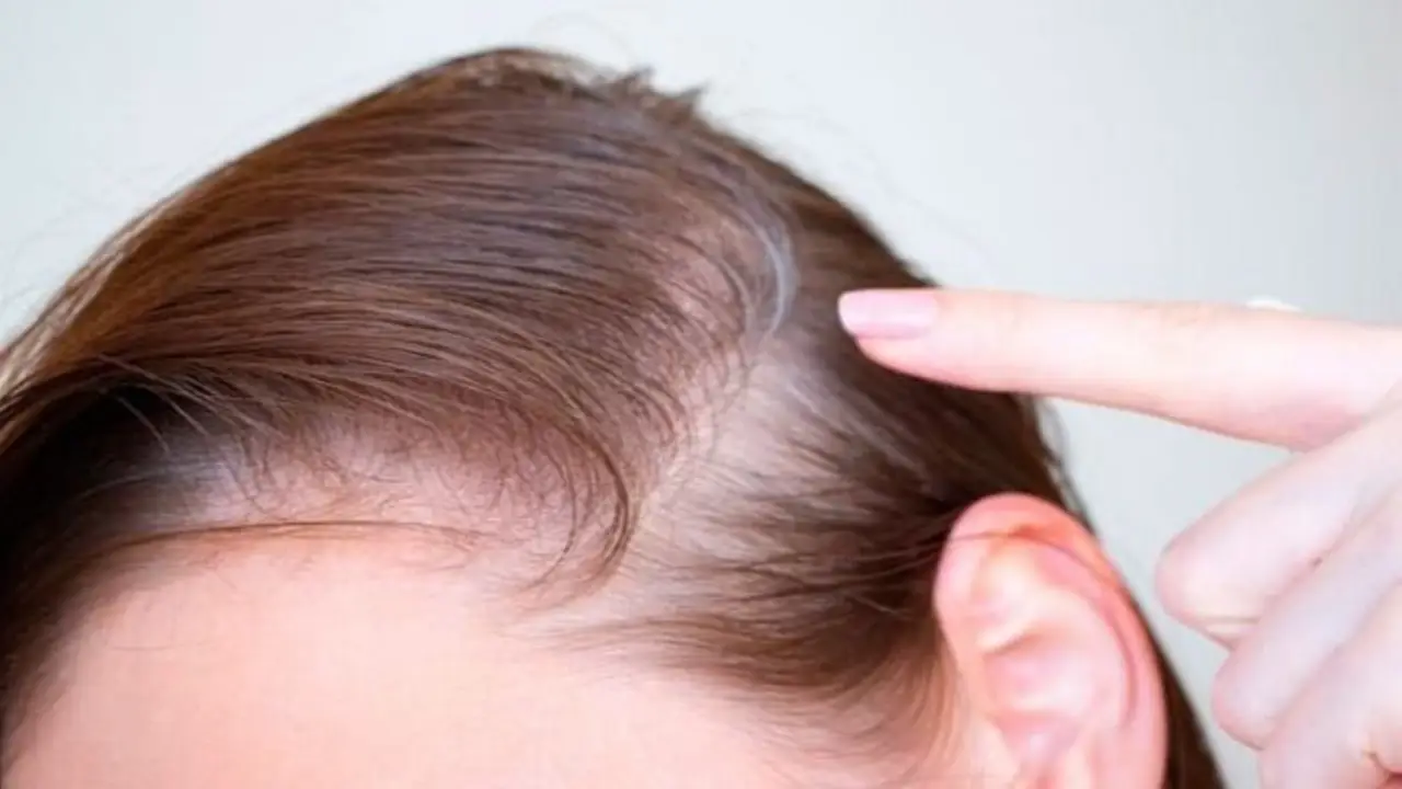 pelo fino
