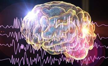 Un estudio sugiere efectos cognitivos positivos del cannabidiol en epilepsia refractaria  | Ciencia 