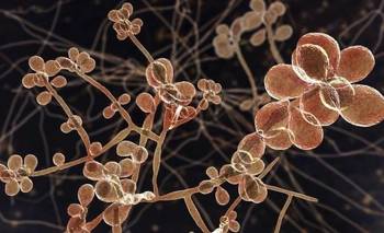 Alerta en Uruguay: brote de hongo transmitido por gatos | Salud