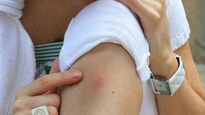 Confirman 216 casos de dengue en Capital y hay "preocupación" Confirman 216 casos de dengue en Capital y hay "preocupación"