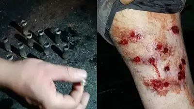 Asesinaron a una mujer y la Ciudad reprimió a vecinos de La Boca Asesinaron a una mujer y la Ciudad reprimió a vecinos de La Boca
