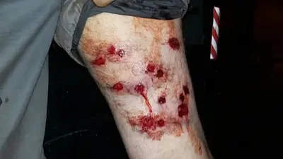 Cruce entre la policía de la Ciudad y la Bonaerense por el caso de gatillo fácil Cruce entre la policía de la Ciudad y la Bonaerense por el caso de gatillo fácil