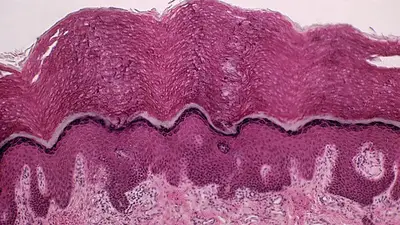 Interstitium: el nuevo órgano humano que descubrieron los científicos Interstitium: el nuevo órgano humano que descubrieron los científicos