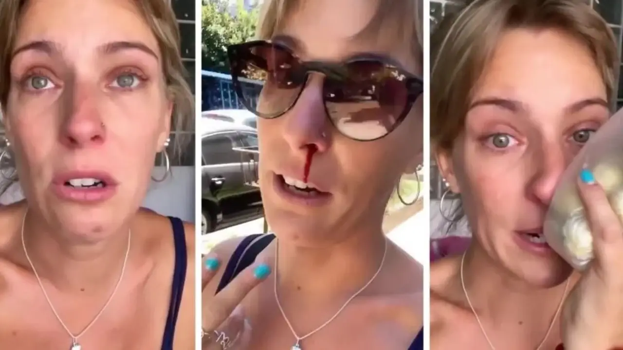 Golpearon a la instagramer Dani "La Chepi" para robarle el celular