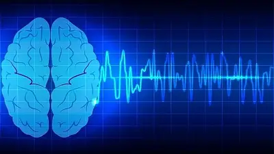 Cómo se cura la epilepsia: el tratamiento adecuado, los síntomas y más Cómo se cura la epilepsia: el tratamiento adecuado, los síntomas y más