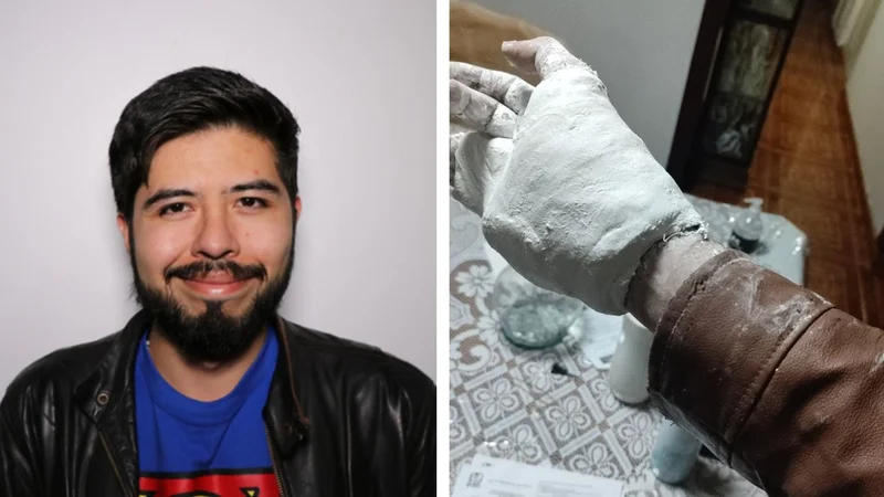Un hombre sufrió un accidente, le pusieron un yeso y no puede sacarse la campera
