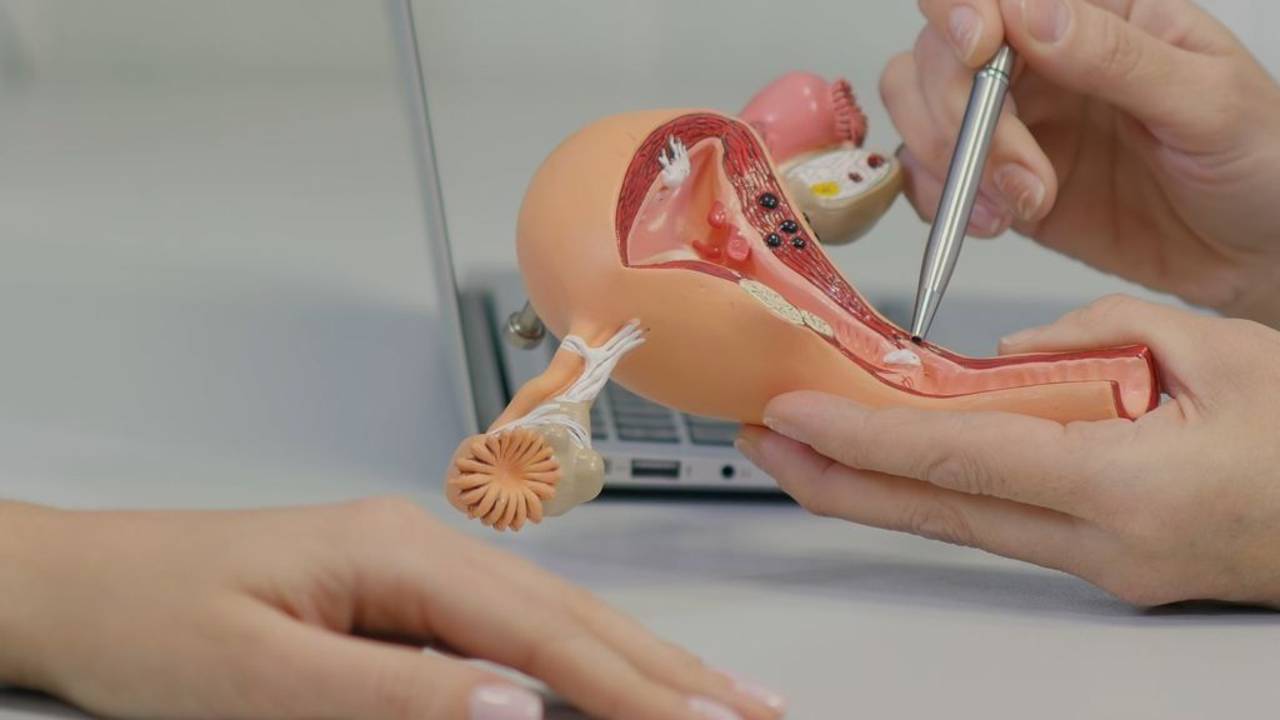 Seis preguntas sobre el cáncer de cuello uterino