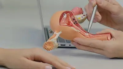 Seis preguntas sobre el cáncer de cuello uterino Seis preguntas sobre el cáncer de cuello uterino