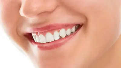 Dientes Dientes
