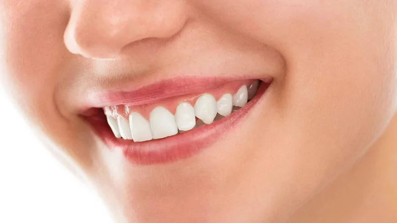 Dientes