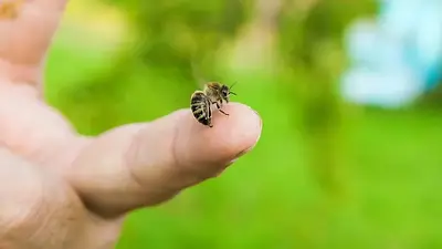 Picadura de abeja Picadura de abeja