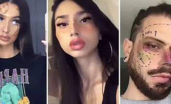 Dismorfia de la selfie: el síndrome que crean los filtros de Instagram | Instagram