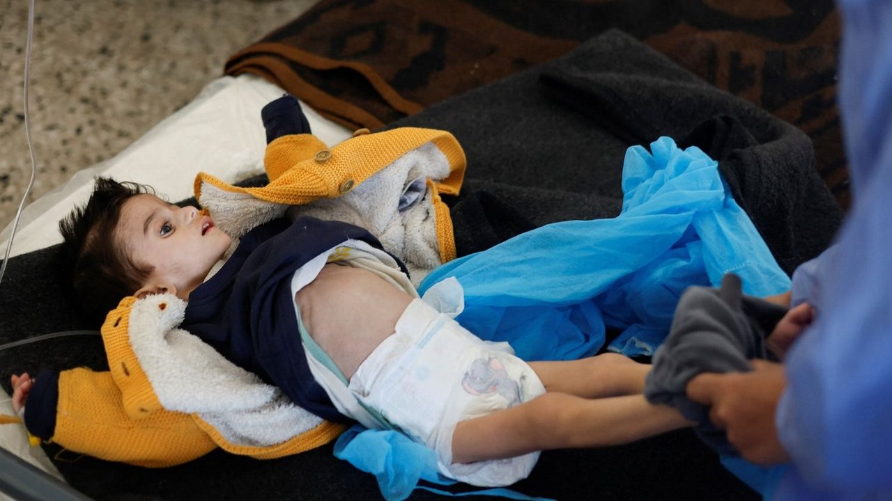 Denuncian que 29 niños y ancianos murieron de hambre en Gaza