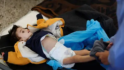 Denuncian que 29 niños y ancianos murieron de hambre en Gaza Denuncian que 29 niños y ancianos murieron de hambre en Gaza
