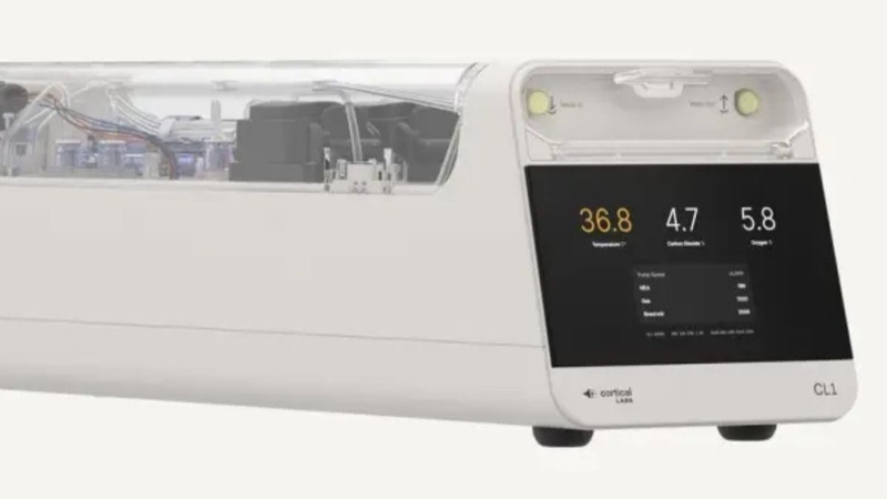 Dónde se inventó la primera computadora biológica del mundo. 