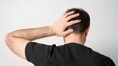 Un hombre agarrandose la cabeza Un hombre agarrandose la cabeza